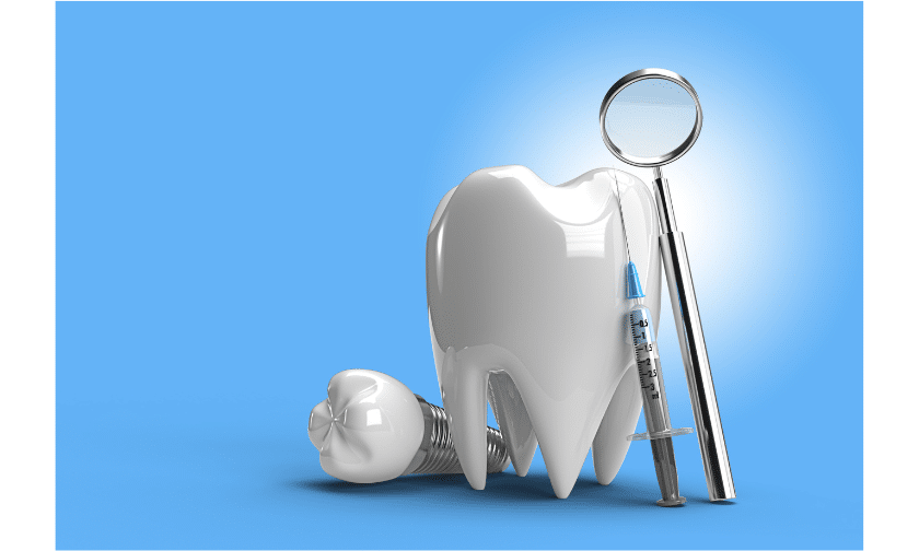 What Are The 5 Amazing Benefits of Dental Implants