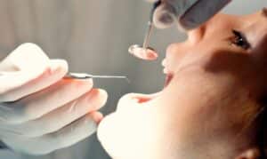 Regular Dental Check-Ups