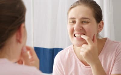 How to Get Rid of White Spots on Teeth: Guide for Lubbock Residents